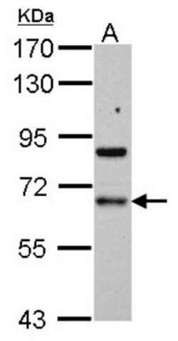 PDLIM5 Antibody, Novus Biologicals 0.1mL; Unlabeled:Antibodies, Polyclonal