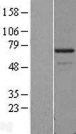 Novus Biologicals&trade;&nbsp;PDLIM5 Overexpression Lysate