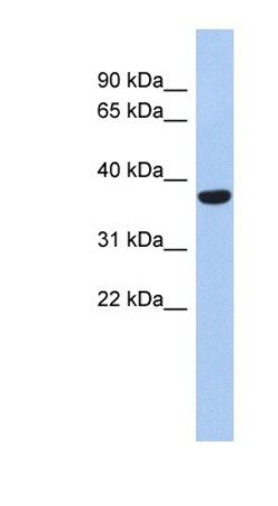 PDP1/PPAPDC2 Antibody, Novus Biologicals:Antibodies:Primary Antibodies