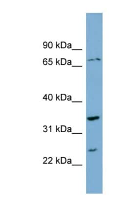 PDP2 Antibody, Novus Biologicals 100 &mu;L | Buy Online | Novus Biologicals | Fisher Scientific