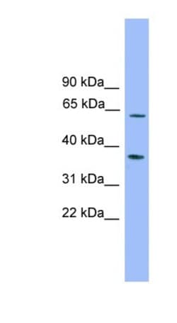 PDP2 Antibody, Novus Biologicals 100&mu;L; Unlabeled:Antibodies, Polyclonal