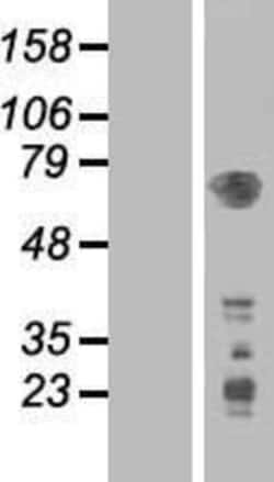 Novus Biologicals&trade;&nbsp;PDK-1 Overexpression Lysate