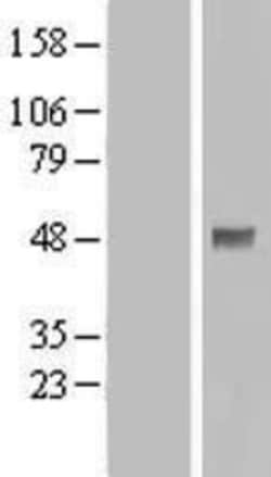 Novus Biologicals&trade;&nbsp;PDK-1 Overexpression Lysate