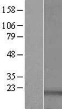 Novus Biologicals&trade;&nbsp;PDRG1 Overexpression Lysate