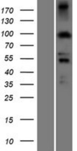 Novus Biologicals™ PDXDC1 Overexpression Lysate
