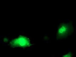 Pyridoxal Kinase/PDXK Antibody (OTI5H5), Novus Biologicals 0.1mL; Unlabeled:Antibodies,