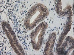 Pyridoxal Kinase/PDXK Antibody (OTI5H5), Novus Biologicals 0.1mL; Unlabeled:Antibodies,