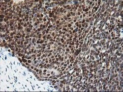 Pyridoxal Kinase/PDXK Antibody (OTI5H5), Novus Biologicals 0.1mL; Unlabeled:Antibodies,