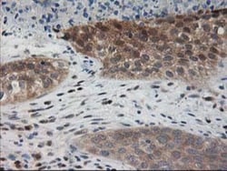 Pyridoxal Kinase/PDXK Antibody (OTI5H5), Novus Biologicals 0.1mL; Unlabeled:Antibodies,