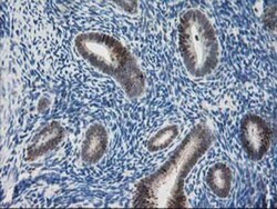 Pyridoxal Kinase/PDXK Antibody (OTI5H5), Novus Biologicals 0.1mL; Unlabeled:Antibodies,