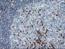 Pyridoxal Kinase/PDXK Antibody (OTI5H5), Novus Biologicals 0.1mL; Unlabeled:Antibodies,