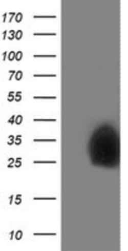 Pyridoxal Kinase/PDXK Antibody (OTI5H5), Novus Biologicals 0.1mL; Unlabeled:Antibodies,