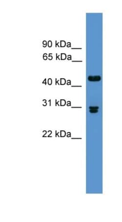 Prodynorphin/PDYN Antibody, Novus Biologicals 20&mu;L; Unlabeled:Antibodies,