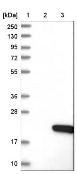 PDZD11 Antibody, Novus Biologicals 0.1mL; Unlabeled:Antibodies, Polyclonal