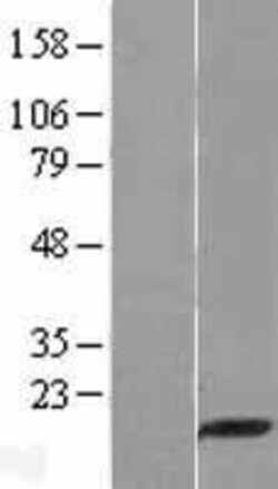 Novus Biologicals&trade;&nbsp;PDZD11 Overexpression Lysate