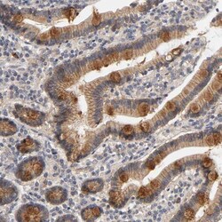 PDZD11 Antibody, Novus Biologicals 0.1mL; Unlabeled:Antibodies, Polyclonal