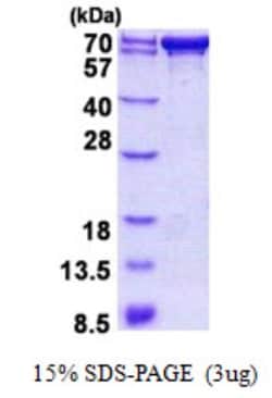 Novus Biologicals&trade;&nbsp;Recombinant Human PDZK1 His Protein