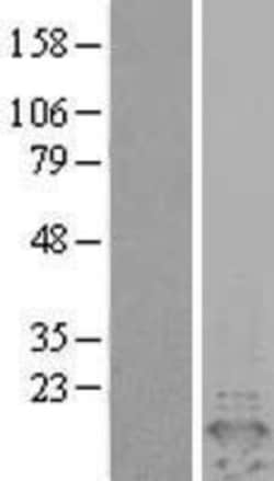 Novus Biologicals&trade;&nbsp;PEA-15 Overexpression Lysate