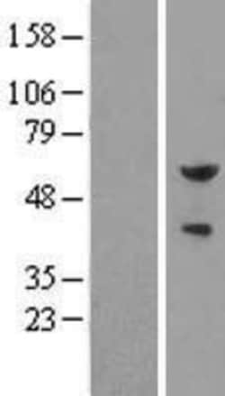 Novus Biologicals&trade;&nbsp;Pea3 Overexpression Lysate