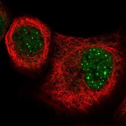 PEAK1 Antibody, Novus Biologicals 0.1mL; Unlabeled:Antibodies, Polyclonal