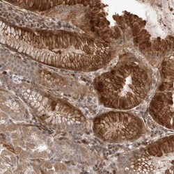 PEAK1 Antibody, Novus Biologicals 0.1mL; Unlabeled:Antibodies, Polyclonal