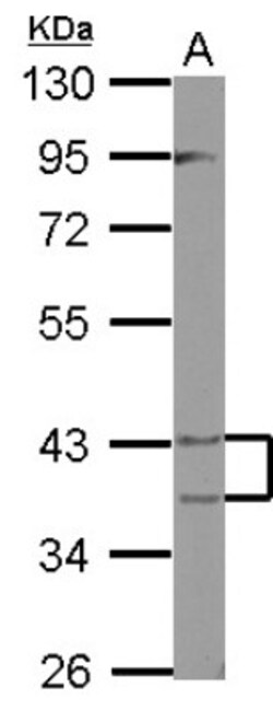 PECI Antibody, Novus Biologicals 0.1mL; Unlabeled:Antibodies, Polyclonal