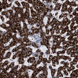 PECI Antibody, Novus Biologicals 0.1 mL | Buy Online | Novus Biologicals | Fisher Scientific