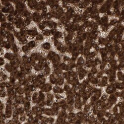 PECR Antibody, Novus Biologicals:Antibodies:Primary Antibodies