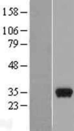 Novus Biologicals&trade;&nbsp;Peflin Overexpression Lysate
