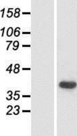 Novus Biologicals&trade;&nbsp;Pejvakin Overexpression Lysate