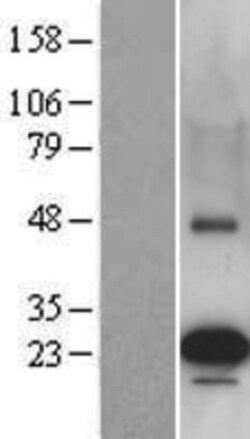 Novus Biologicals&trade;&nbsp;PEMT Overexpression Lysate
