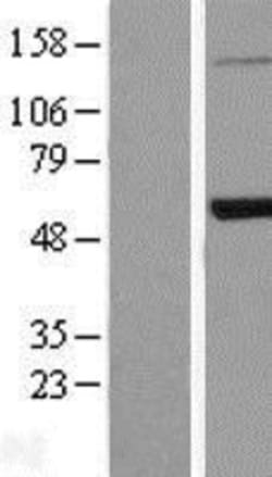 Novus Biologicals&trade;&nbsp;PEPD Overexpression Lysate