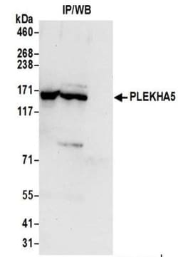 PEPP2 Antibody, Novus Biologicals 0.1mL:Antibodies, Polyclonal
