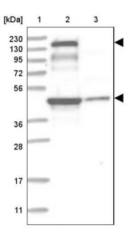 PEPP2 Antibody, Novus Biologicals 0.1mL; Unlabeled:Antibodies, Polyclonal