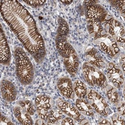 PEPP3 Antibody, Novus Biologicals:Antibodies:Primary Antibodies