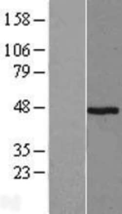 Novus Biologicals&trade;&nbsp;Pepsinogen A Overexpression Lysate