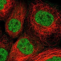 Pepsinogen C/PGC/Progastricsin Antibody, Novus Biologicals 0.1mL; Unlabeled:Antibodies,