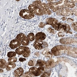 Pepsinogen C/PGC/Progastricsin Antibody, Novus Biologicals 0.1mL; Unlabeled:Antibodies,