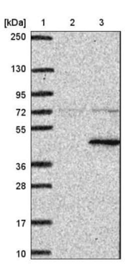 Pepsinogen C/PGC/Progastricsin Antibody, Novus Biologicals 0.1mL; Unlabeled:Antibodies,