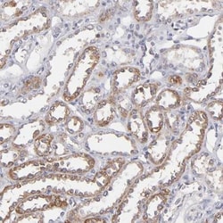 PEPT1/SLC15A1 Antibody, Novus Biologicals 25 &mu;L, Unconjugated:Antibodies,