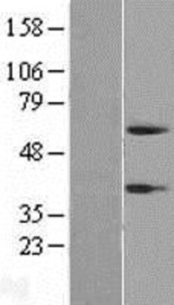 Novus Biologicals™ Peptidase Inhibitor 16/PI16 Overexpression Lysate