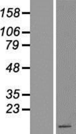 Novus Biologicals™ Peptide YY Overexpression Lysate