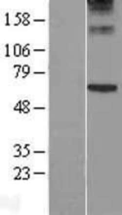 Novus Biologicals Perforin Overexpression Lysate 0.1 mg | Buy Online | Novus Biologicals&trade; | Fisher Scientific