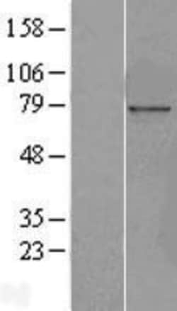 Novus Biologicals™ Nucleoporin NUP85 Overexpression Lysate