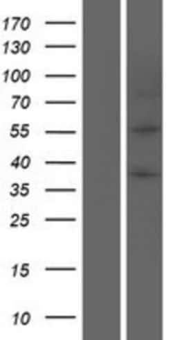 Novus Biologicals&trade;&nbsp;Perilipin Overexpression Lysate