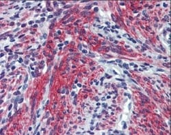Periostin/OSF-2 Antibody, Novus Biologicals:Antibodies:Primary Antibodies