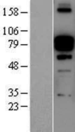Novus Biologicals™ Periostin/OSF-2 Overexpression Lysate