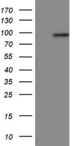 Periostin/OSF-2 Antibody (OTI2B2), Novus Biologicals 0.1mL; Unlabeled:Antibodies,