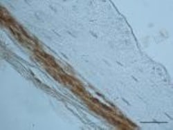 Periostin/OSF-2 Antibody - C-terminus - Azide and BSA Free, Novus Biologicals