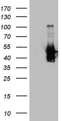 Peripherin Antibody (OTI1E10), Novus Biologicals 0.1mL; Unlabeled:Antibodies,